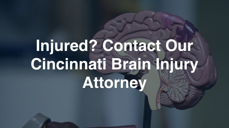 Cincinnati Brain Injury Attorney